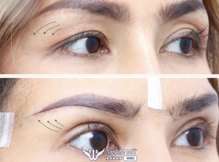 Địa chỉ treo cung chân mày đẹp ở TPHCM - La Ratio