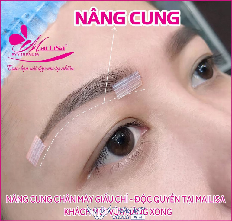 Nâng cung chân mày tại TPHCM ở đâu đẹp? Mailisa