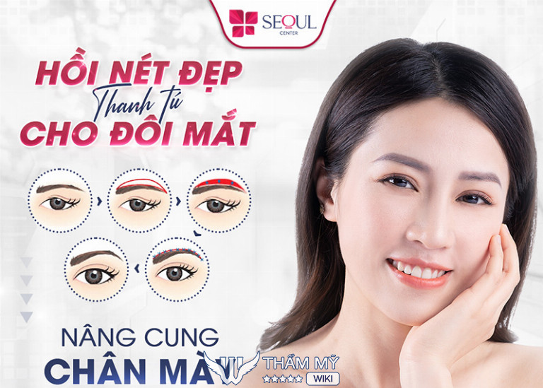 Địa chỉ treo cung chân mày tại TPHCM đẹp, uy tín - Thẩm mỹ viện Seoul Center