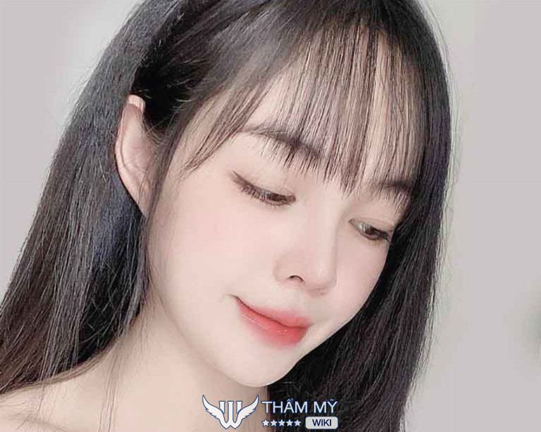 Địa chỉ xoá nọng cằm uy tín ở TPHCM - Bác sĩ Lê Trần Duy