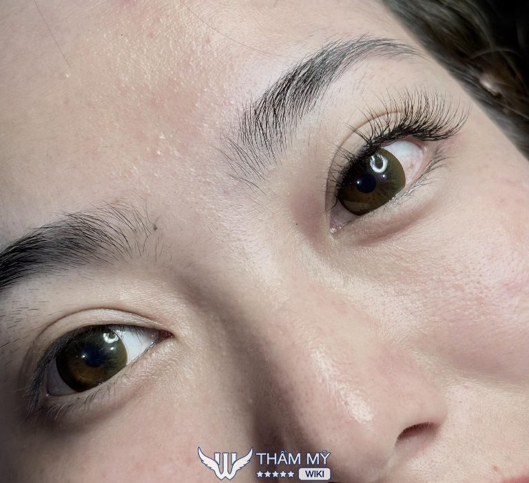 Quyên Nối mi Bạc Liêu