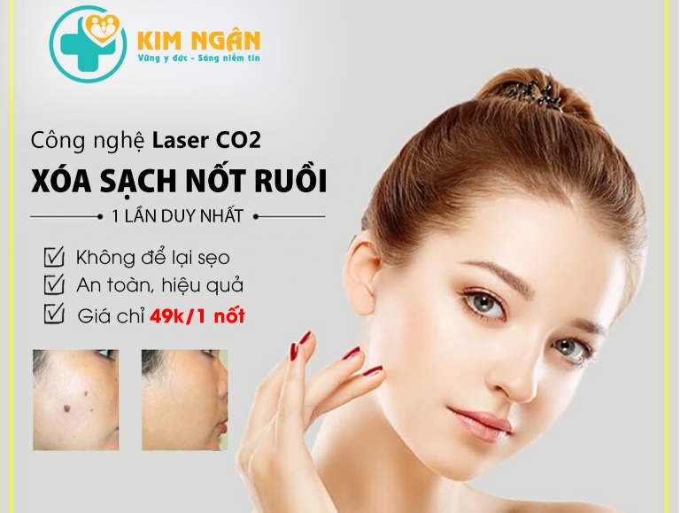 Địa chỉ tẩy nốt ruồi tại Thái Bình - Thẩm Mỹ Kim Ngân