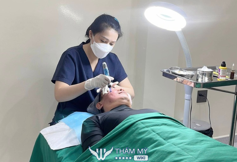 LAVIO Spa & Clinic trị sẹo rỗ ở Cần Thơ 