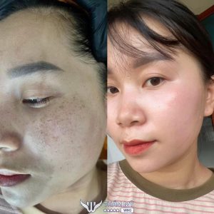 8 Spa ở Lai Châu uy tín, dịch vụ đa dạng, giá tốt