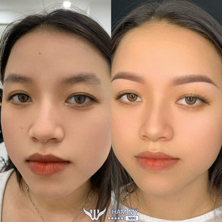 Paov Spa tại Lai Châu