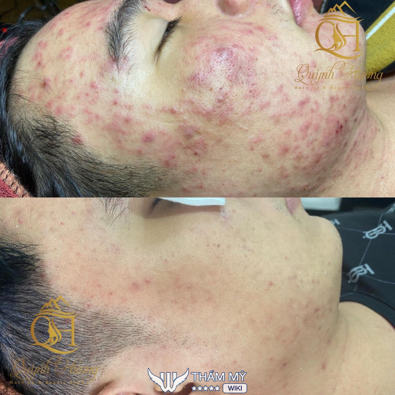 Quỳnh Hương Beauty Center Spa ở Lai Châu