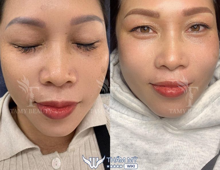 Tamy Beauty Spa ở Yên Bái