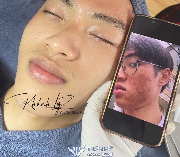 Khánh Ly Spa & Clinic ở Yên Bái