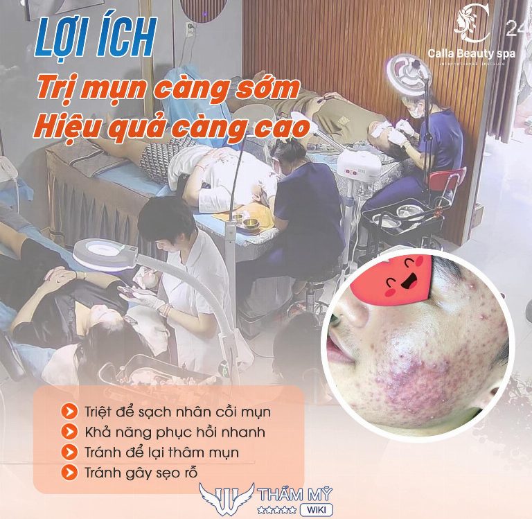 Calla Beauty spa trị mụn ở Củ Chi