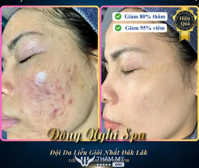 Đông Nghi Spa ở Đắk Lắk