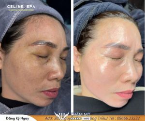 5 Spa ở Đông Triều làm đẹp uy tín, công nghệ cao