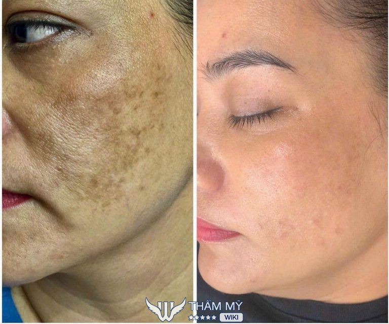 Mộc Spa ở Đông Triều