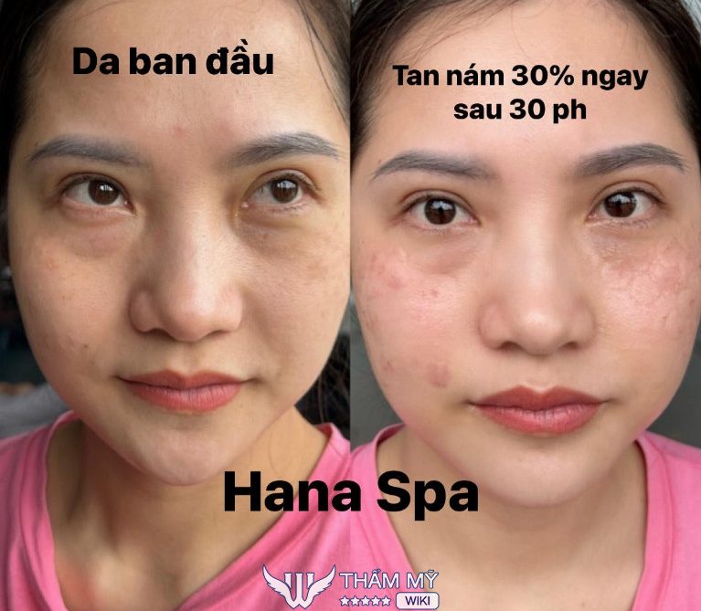 Spa Hana ở Thạch Thất
