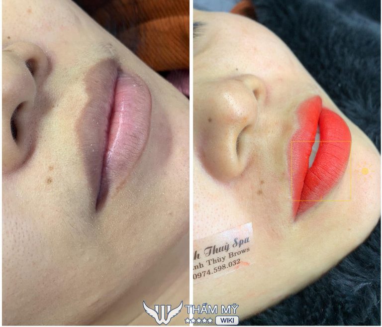 Thanh Thuỳ Spa ở Tiền Giang