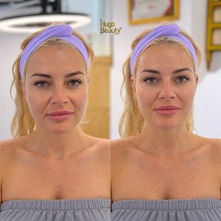 Hugo beauty